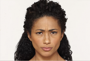 Botox Before and After Pictures West Palm Beach, FL