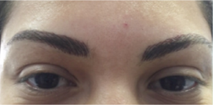 Permanent Makeup Before and After Pictures West Palm Beach, FL