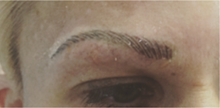 Permanent Makeup Before and After Pictures West Palm Beach, FL