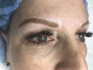 Permanent Makeup Before and After Pictures West Palm Beach, FL