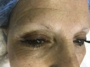 Permanent Makeup Before and After Pictures West Palm Beach, FL