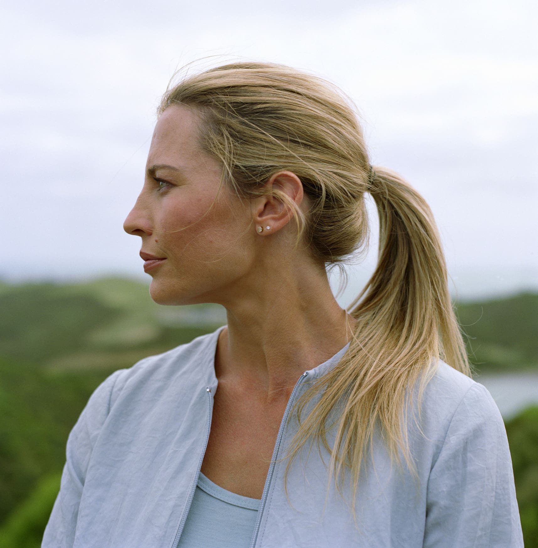 Woman outdoors, profile Rhinoplasty in West Palm Beach and Jupiter, FL
