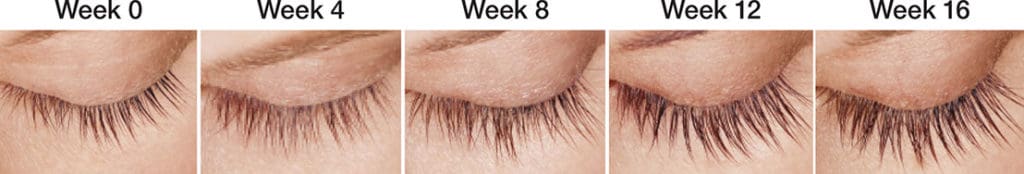Latisse® in West Palm Beach and Jupiter, FL