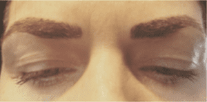 Permanent Makeup Before and After Pictures West Palm Beach, FL