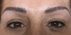 Permanent Makeup Before and After Pictures West Palm Beach, FL