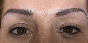 Permanent Makeup Before and After Pictures West Palm Beach, FL
