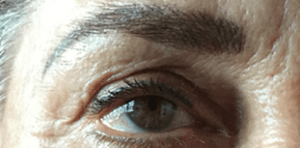 Permanent Makeup Before and After Pictures West Palm Beach, FL
